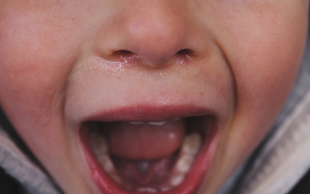 Photo Childrens antacid