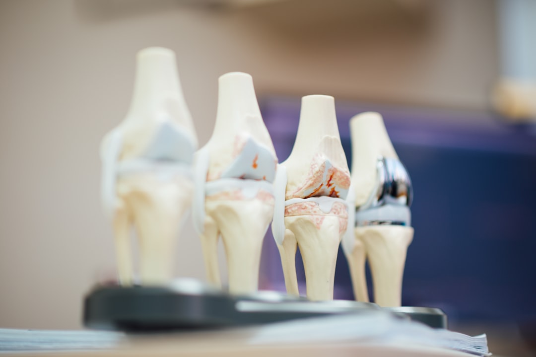 Photo Joint pain