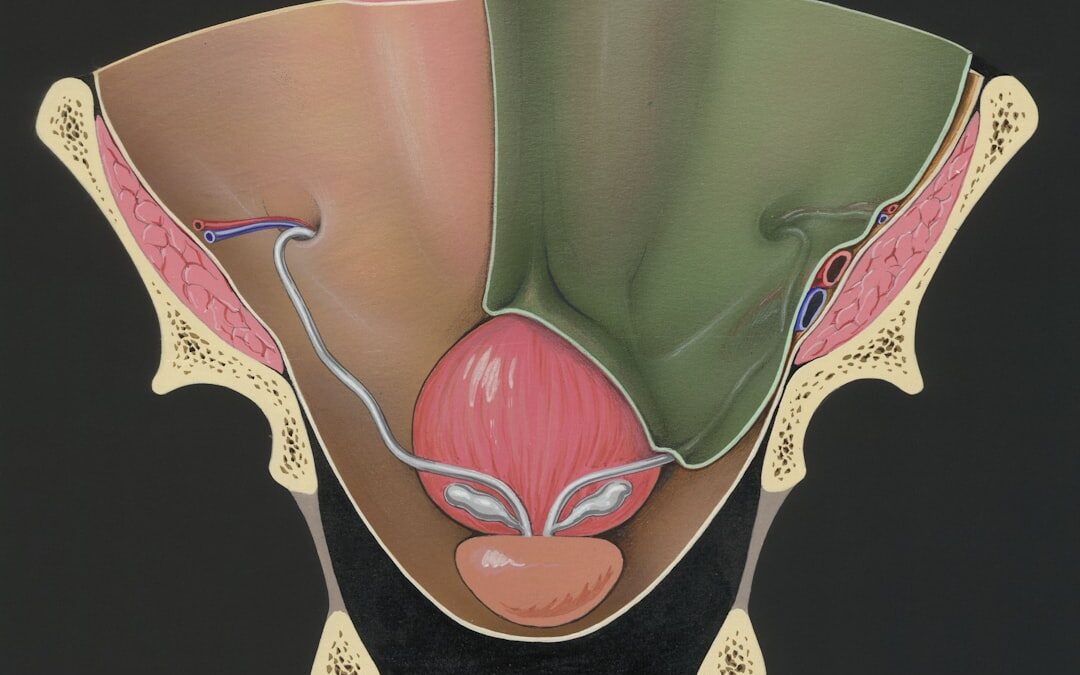 Photo Endoscopic ablation