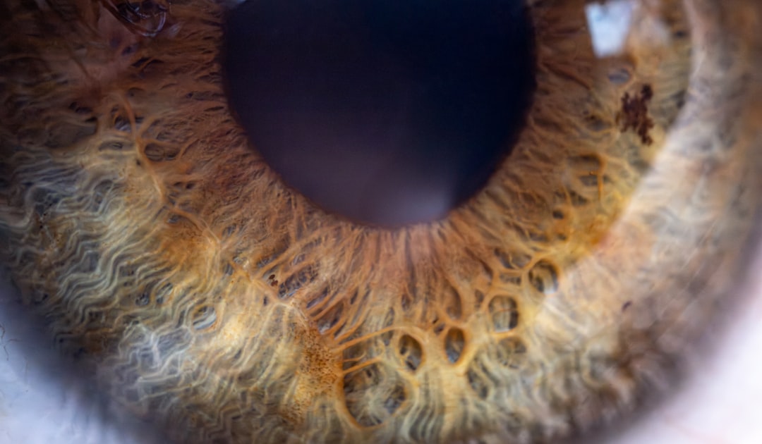 Photo Eye tumor