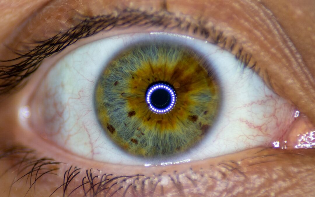 Photo Eye examination