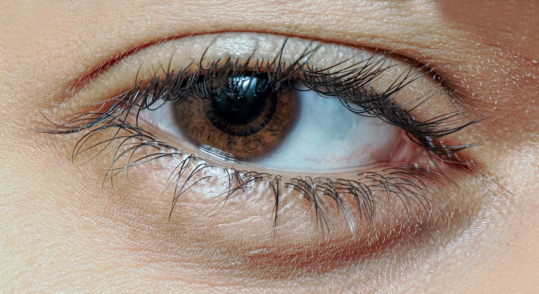 Photo Eye examination