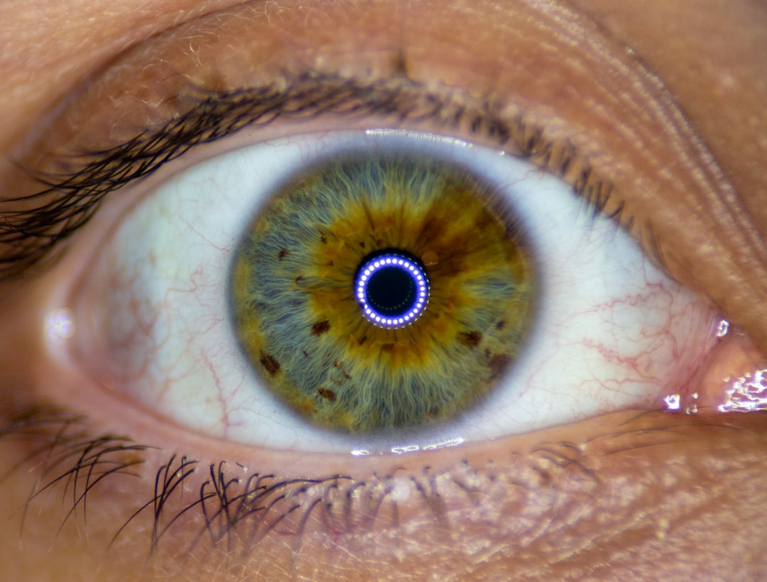 Photo Eye tumor