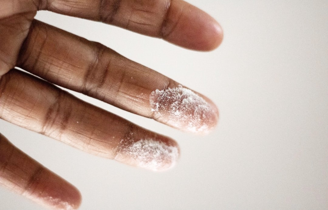 Photo Skin peeling