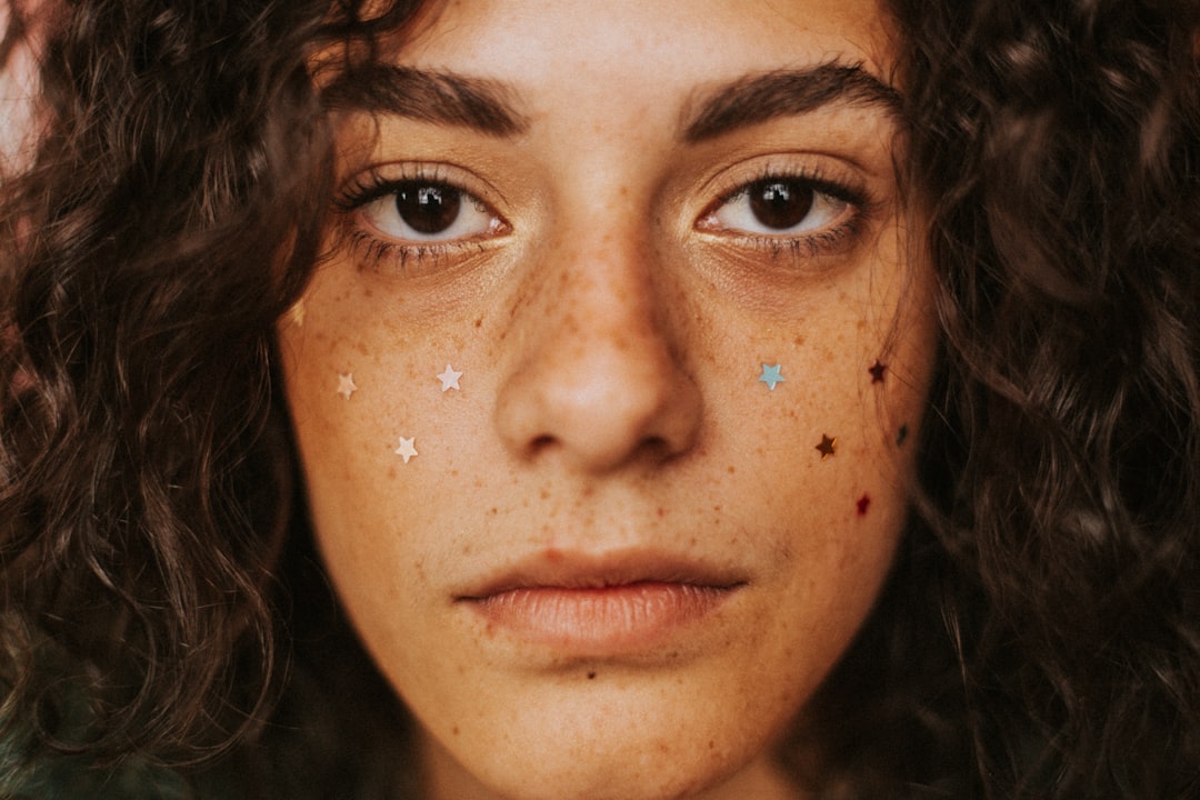 Photo Skin with white spots
