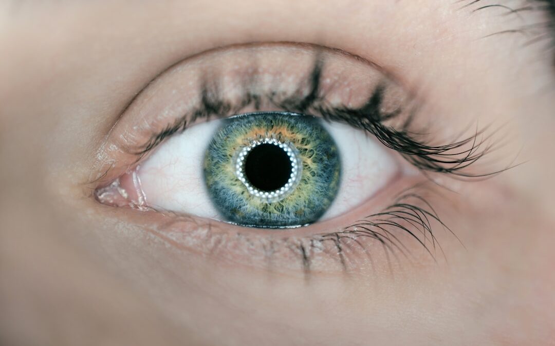 Photo Eye surgery
