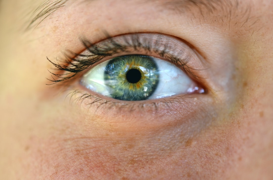 Photo Eye exercises