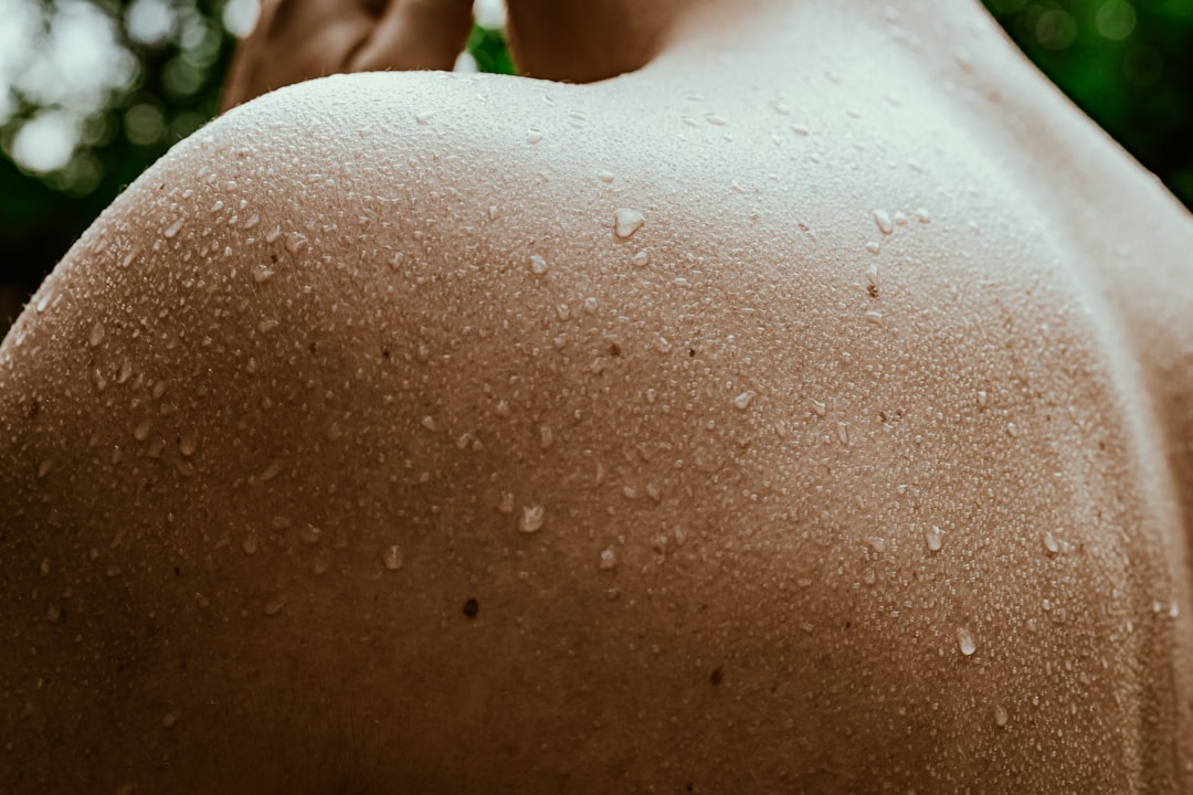 Photo itchy skin