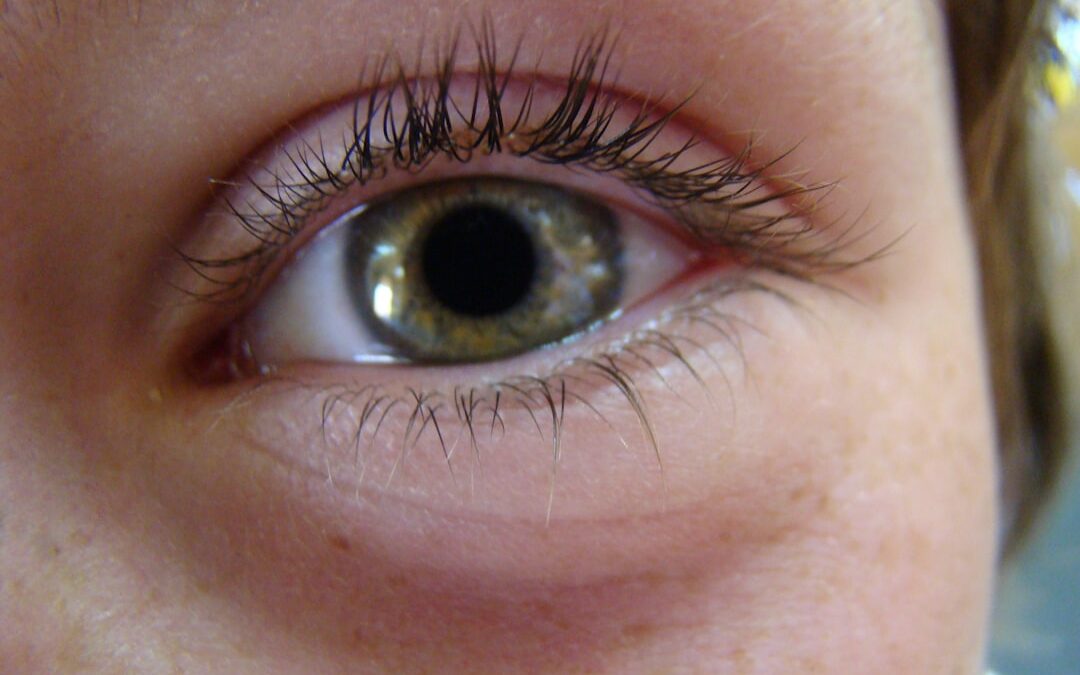 Photo Eye tumor