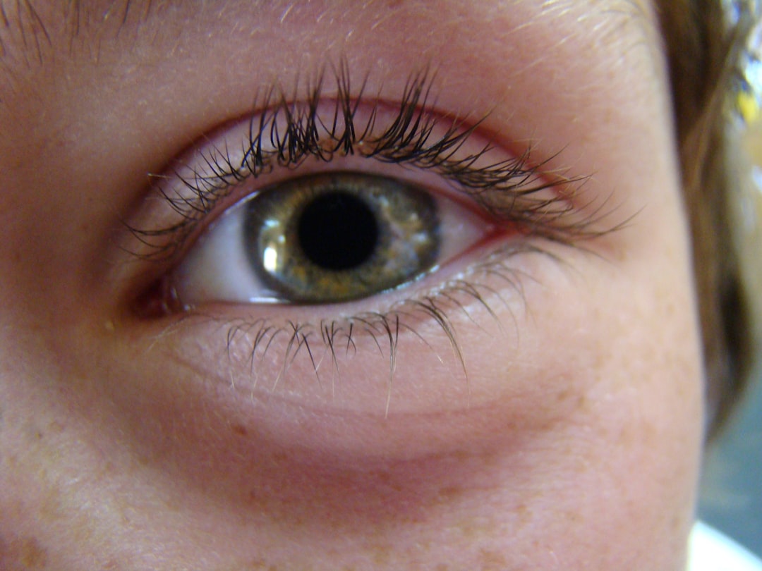 Photo Eye tumor
