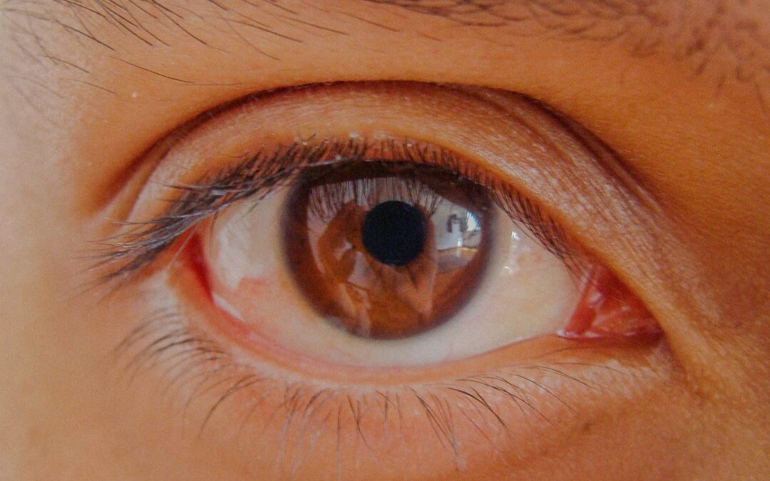 Photo Eye inflammation