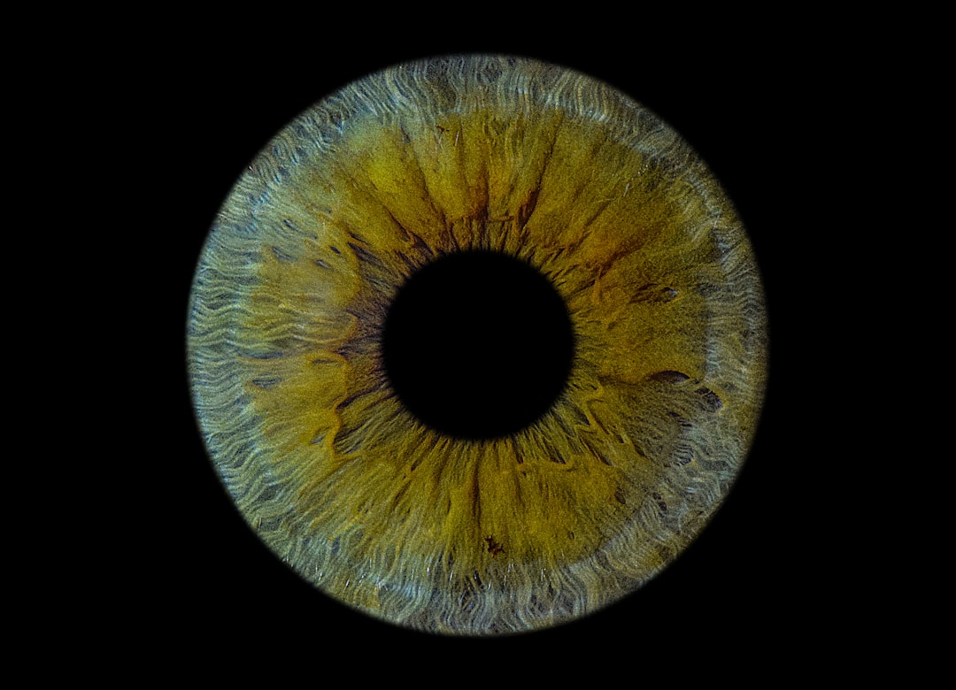 Photo Eye diagram