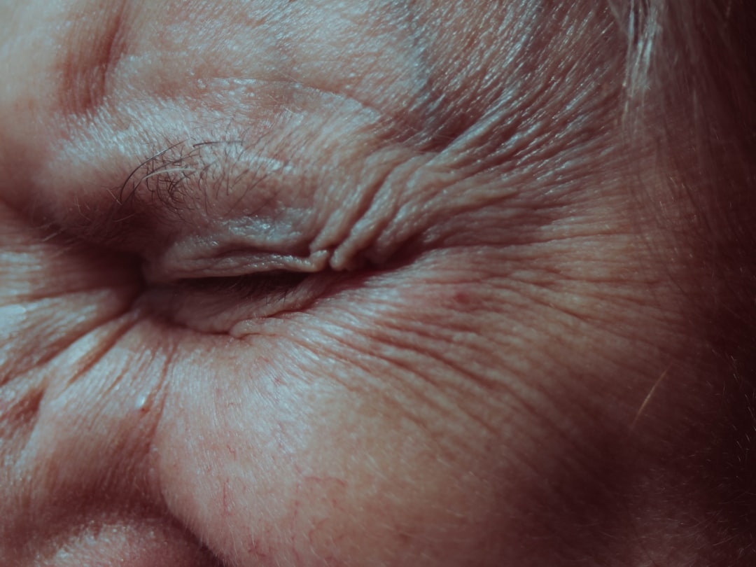 Photo Anti-aging cream