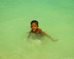 Photo Sunburned child