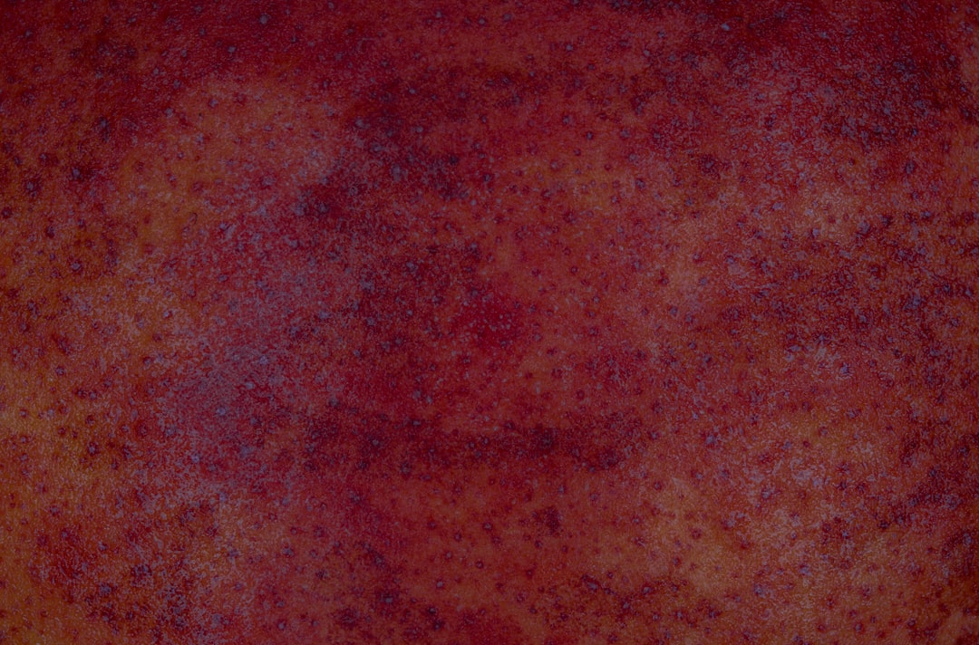 Photo Red rash