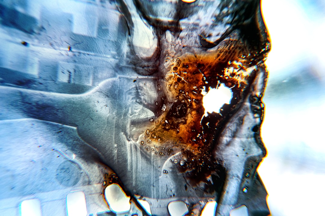 Photo Kidney damage