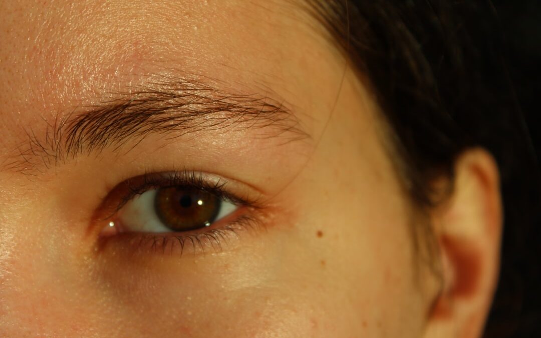 Photo Sunburned skin