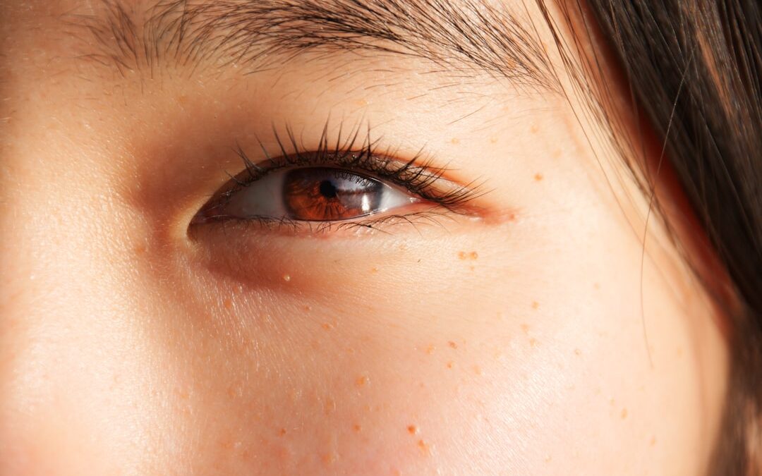 Photo Swollen eyes