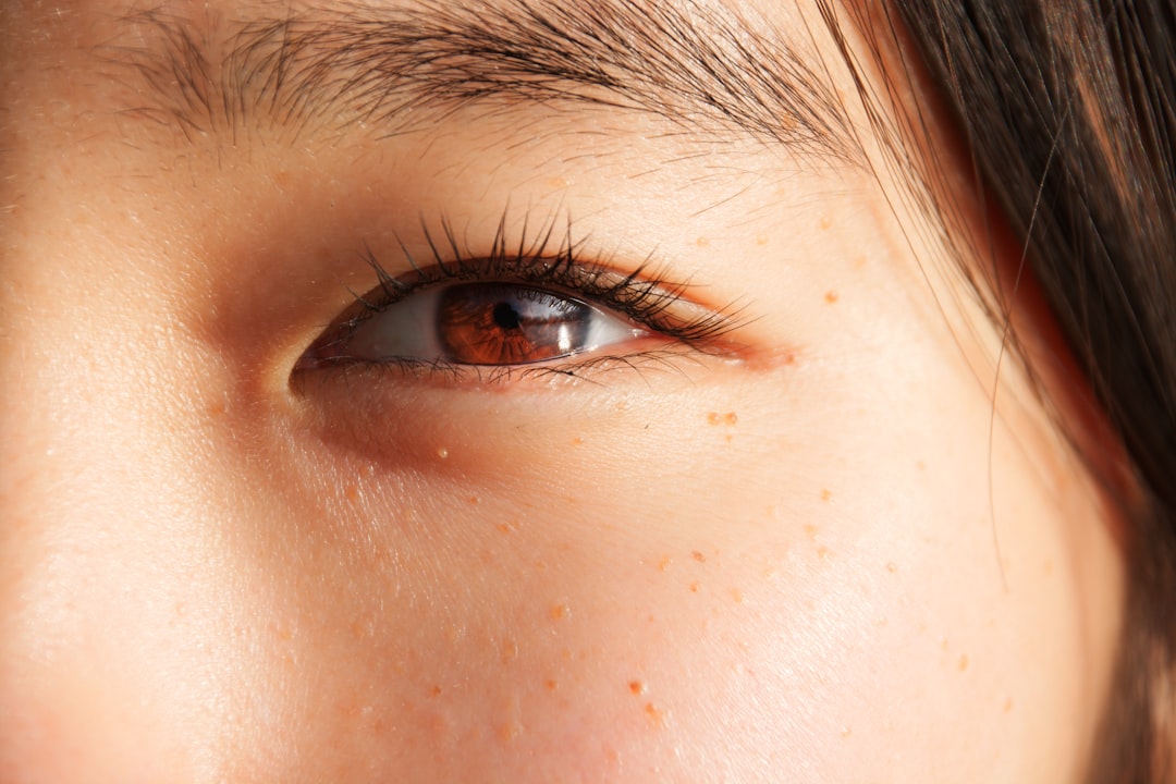 Photo Swollen eyes