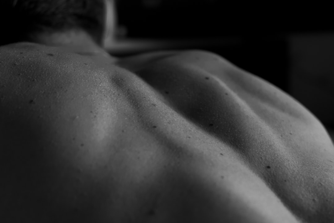 Photo Stretch marks