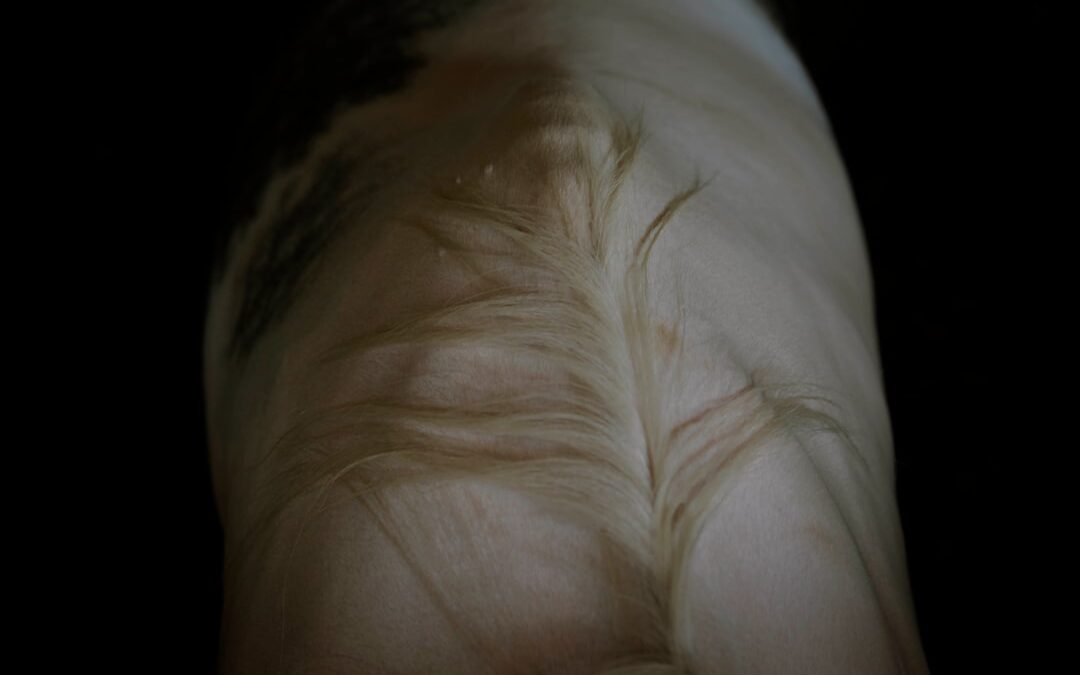Photo Stretch marks