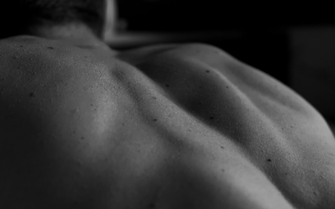 Photo Stretch marks