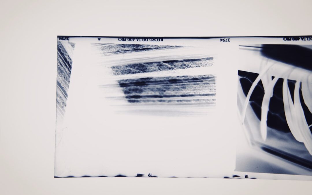 Photo MRI scan