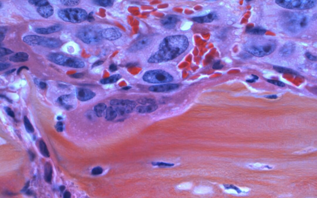 Photo Thyroid gland