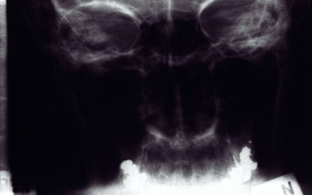 Photo Thyroid surgery