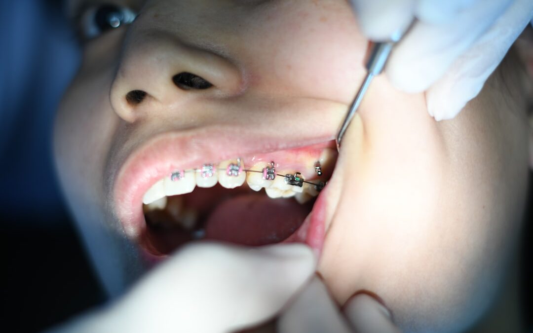 Photo Oral cavity