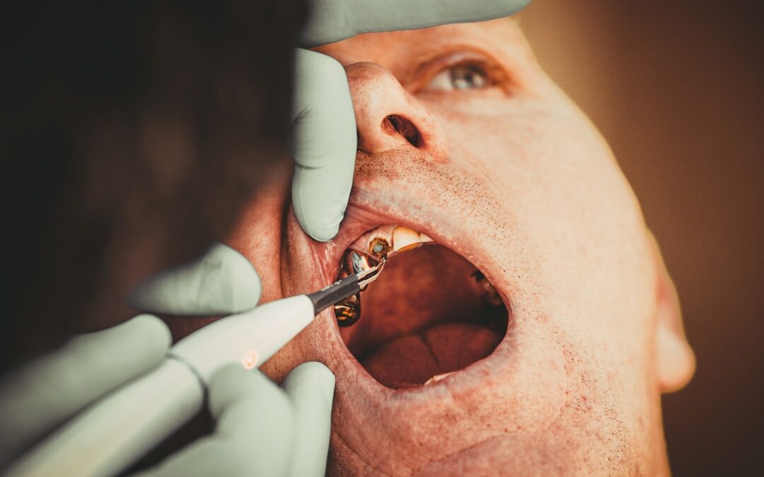 Photo Oral Surgery