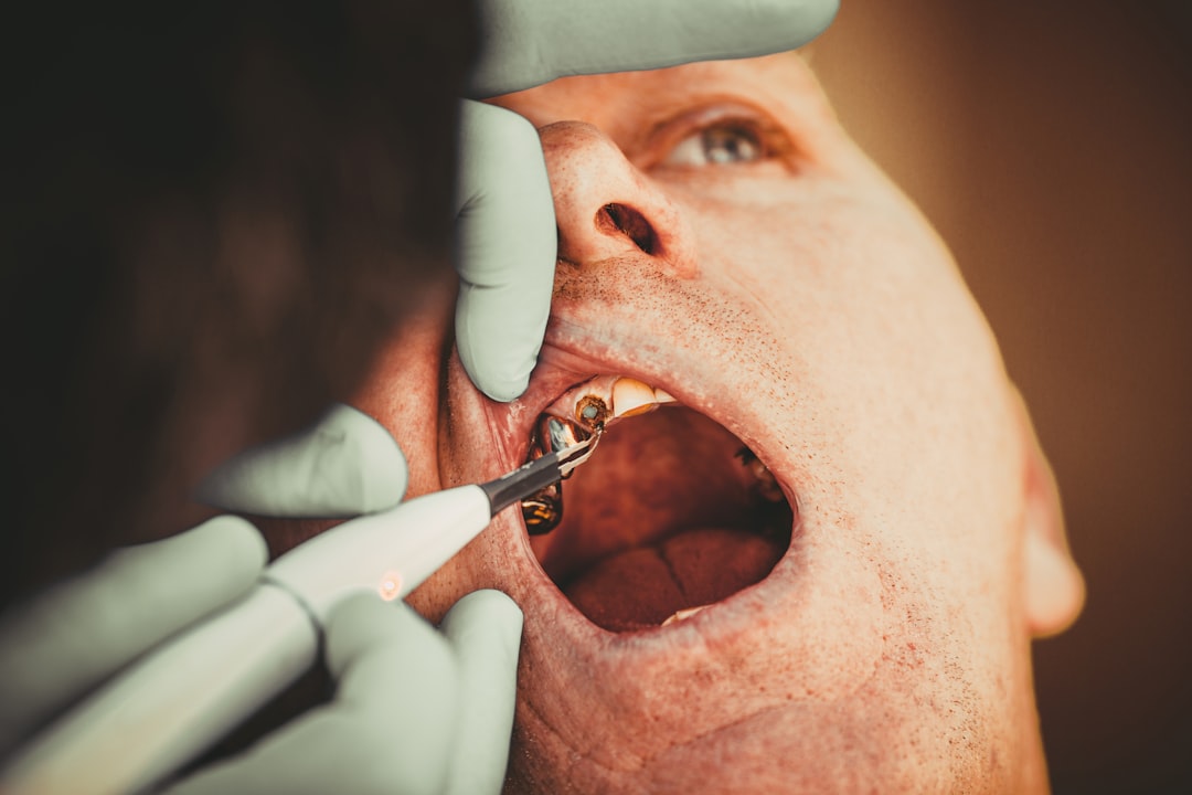 Photo Oral Surgery