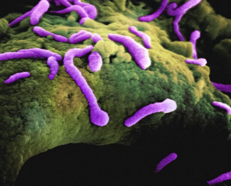 Photo Salmonella bacteria