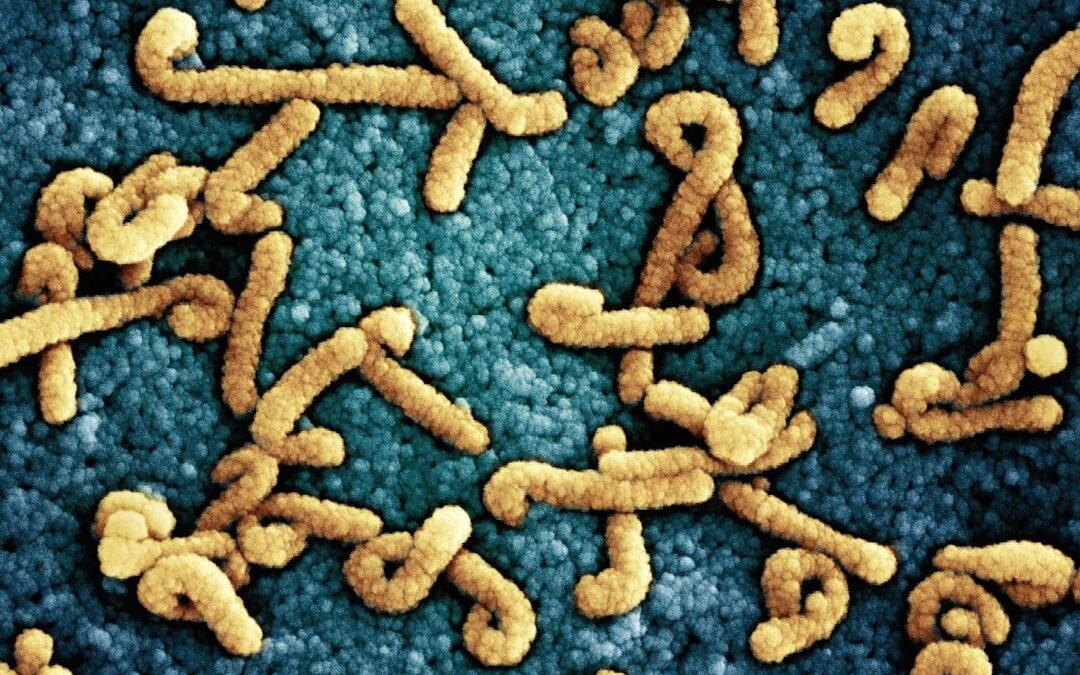 Photo Salmonella bacteria