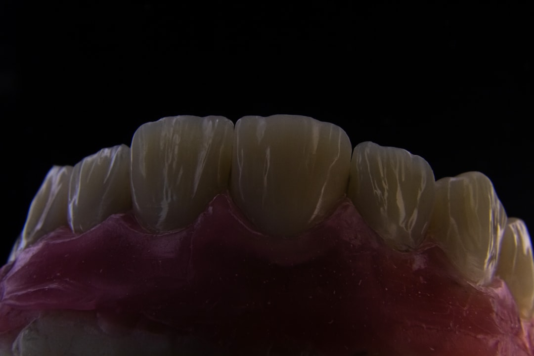 Photo Oral Thrush