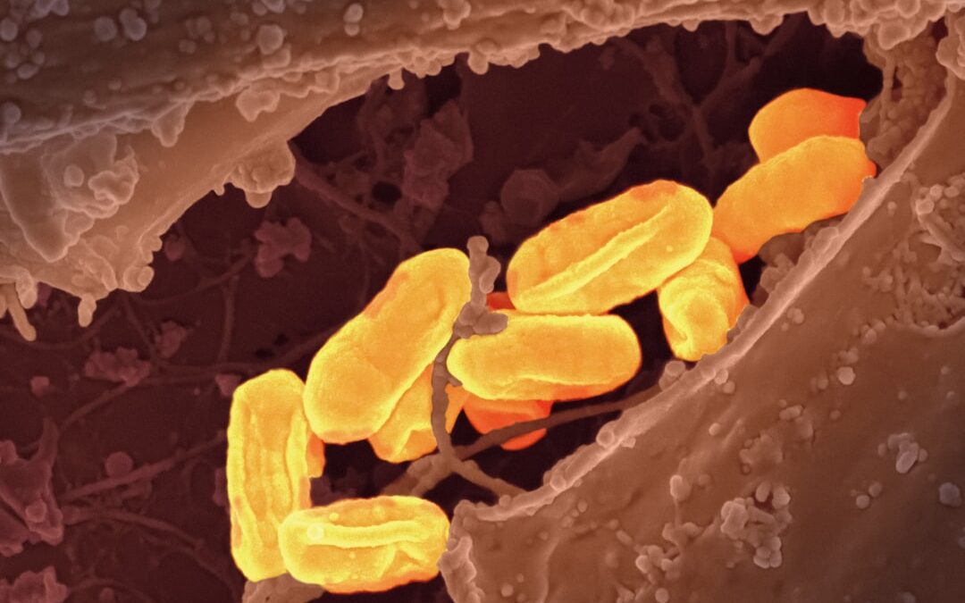 Photo Salmonella bacteria