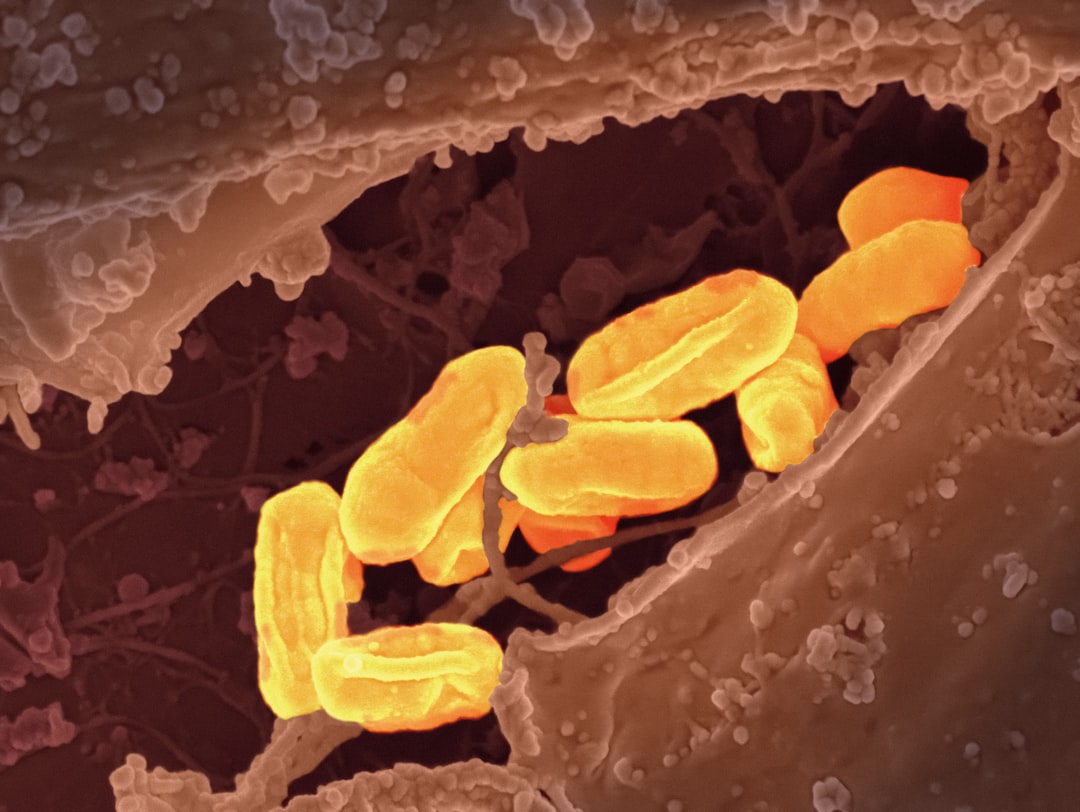 Photo Salmonella bacteria