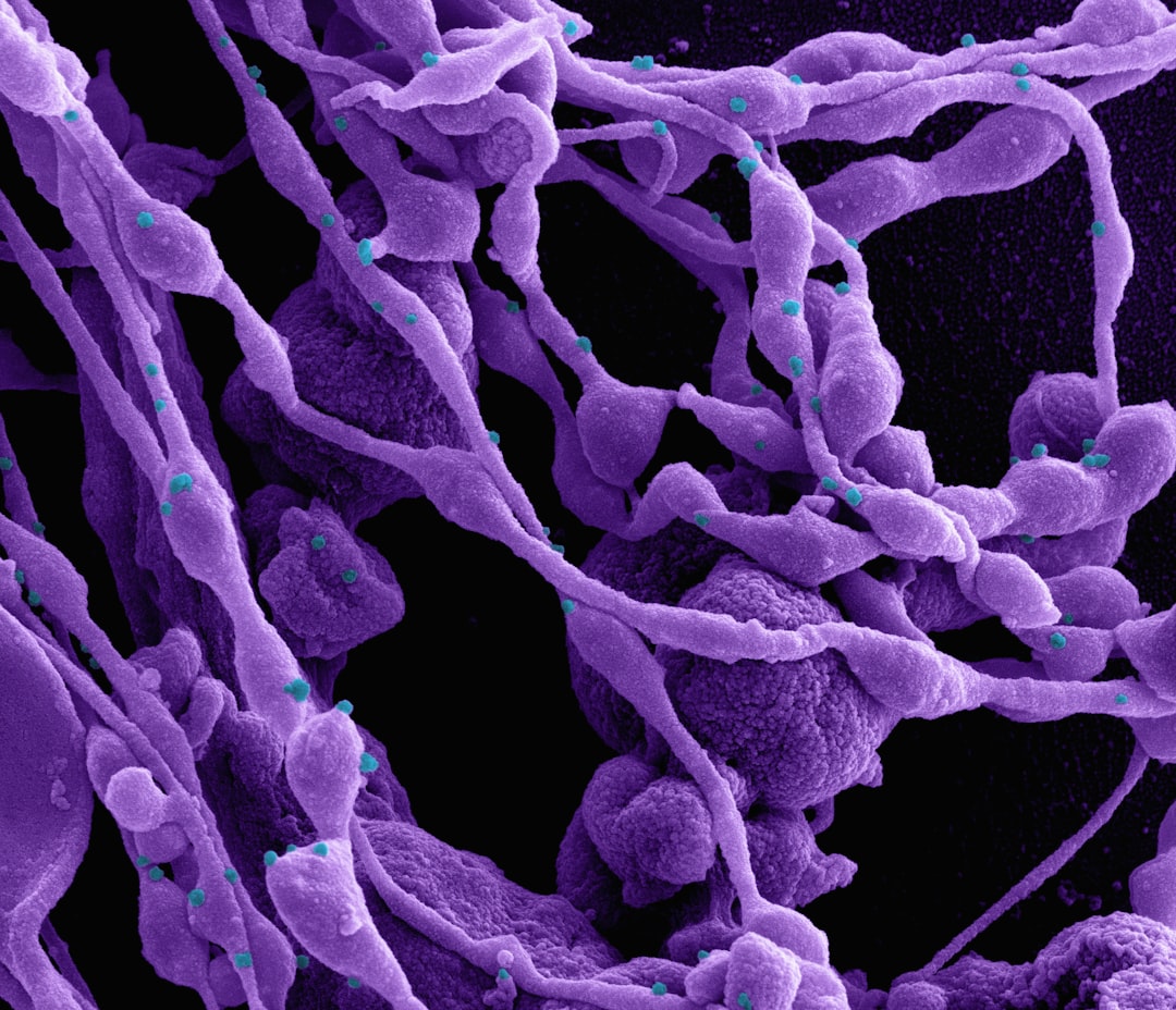 Photo Salmonella bacteria
