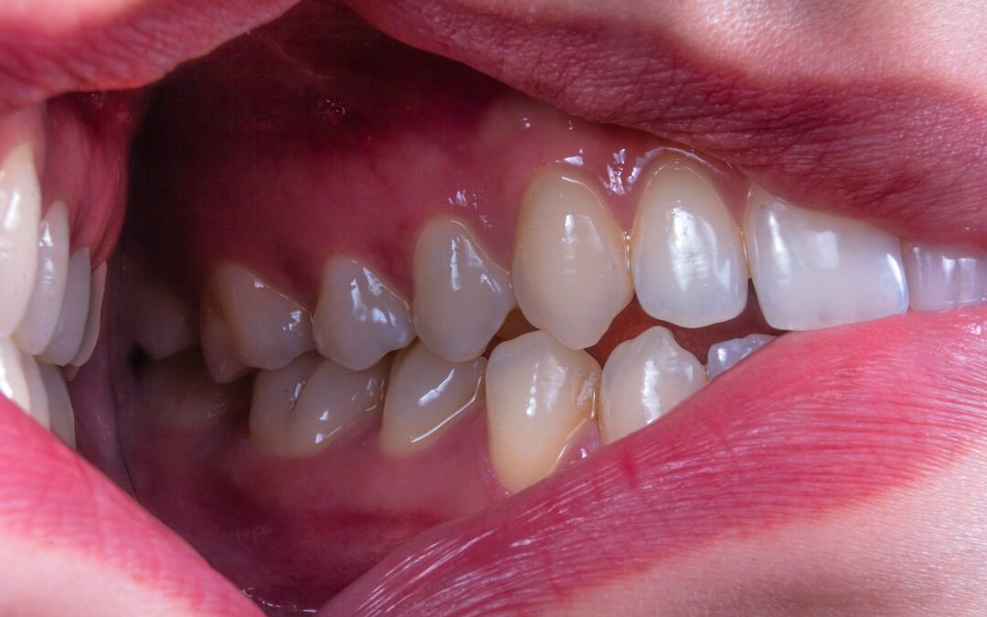 Photo Throat lozenges