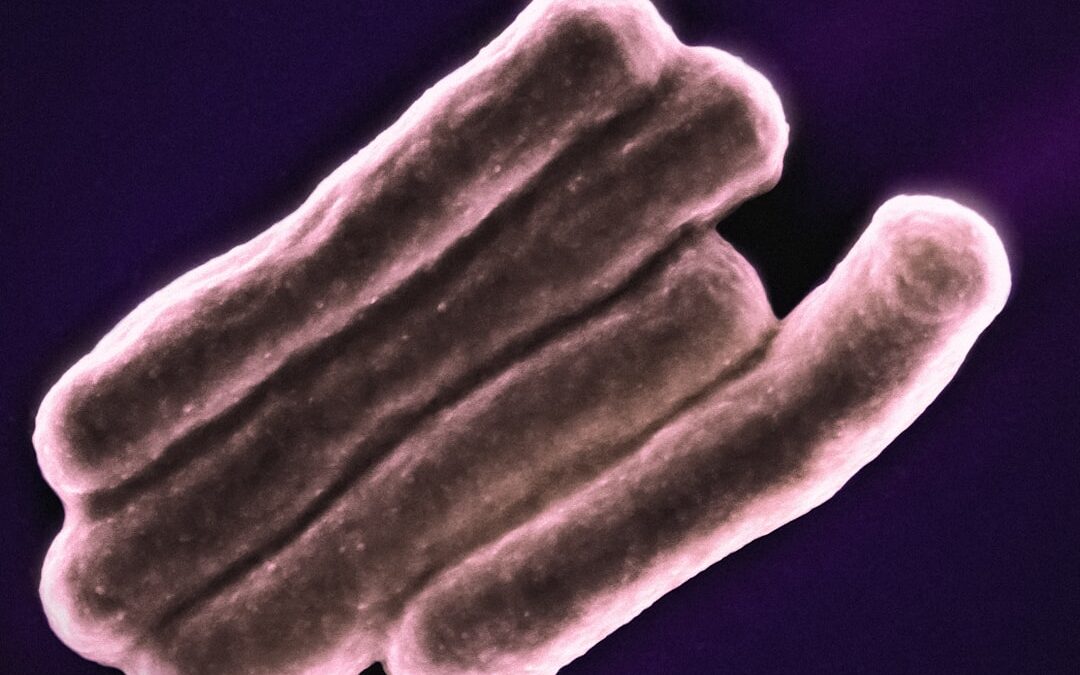 Photo Salmonella bacteria
