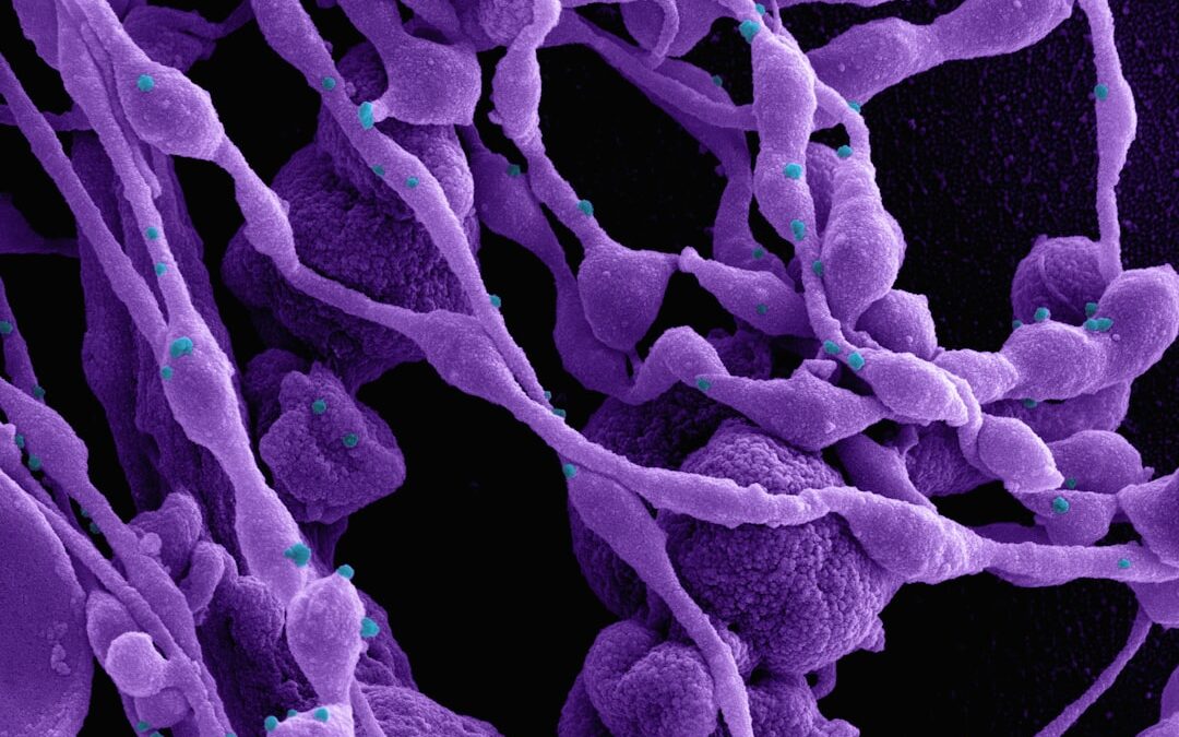 Photo Salmonella bacteria