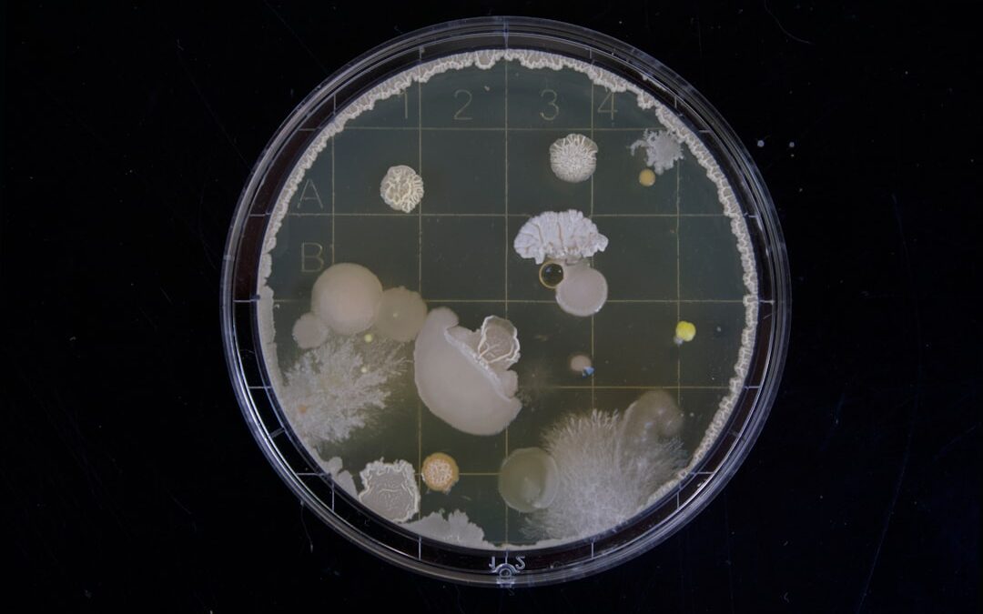 Photo Bacteria growth