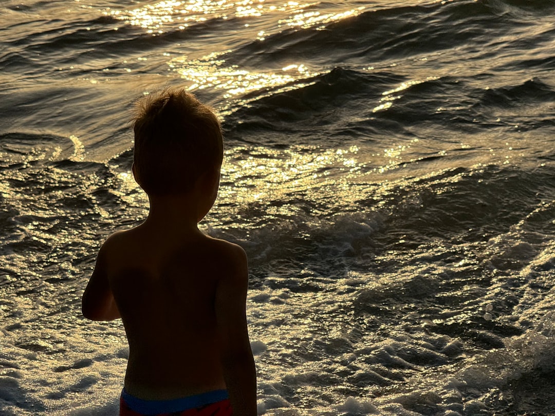 Photo Sunburned child
