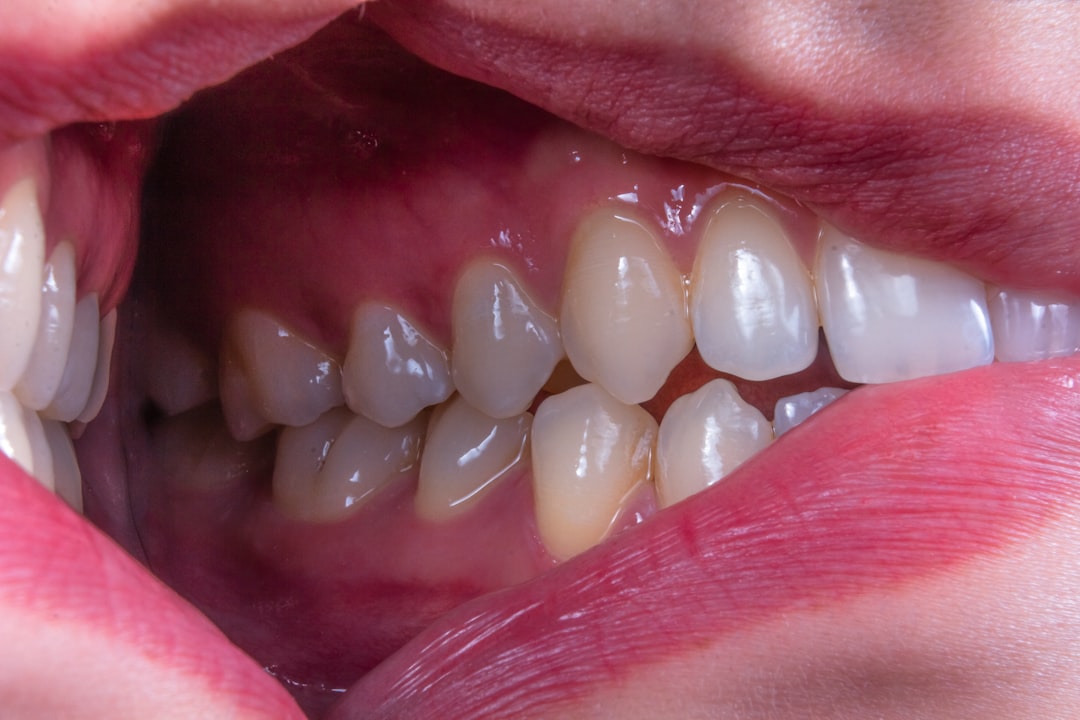 Photo Throat lozenges