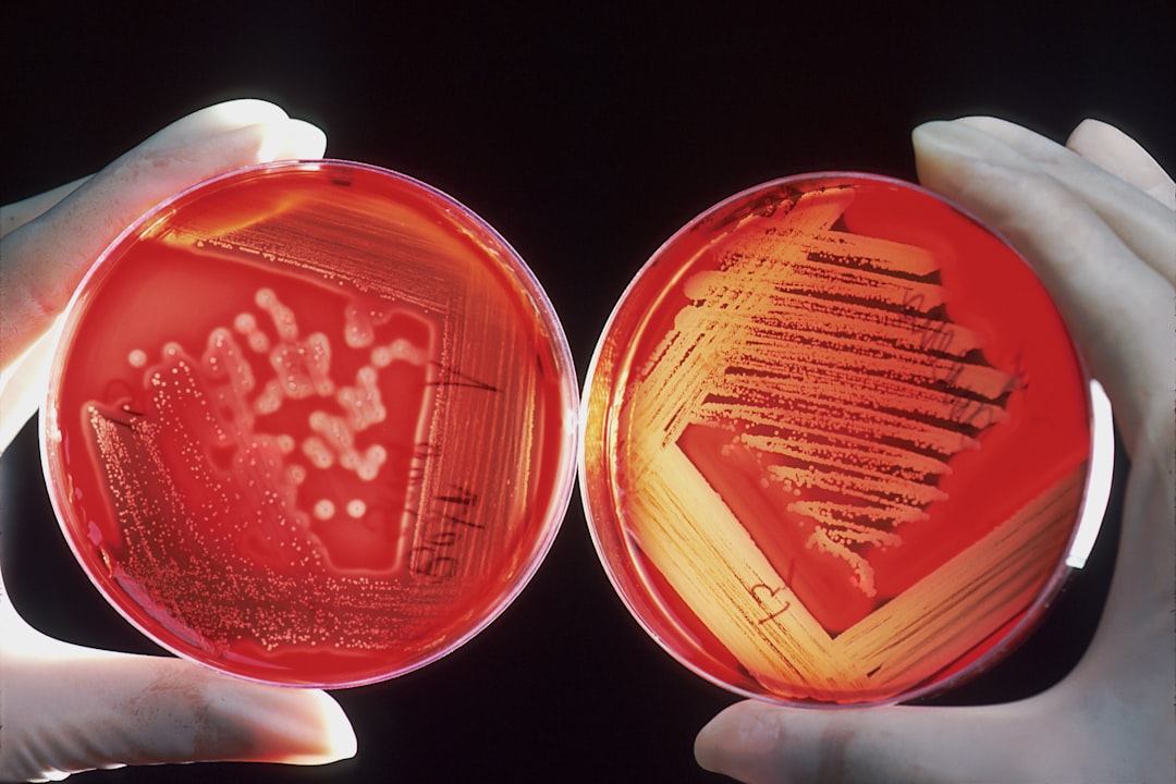 Photo Salmonella bacteria