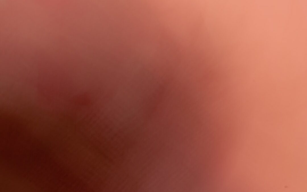 Photo Bordetella pertussis