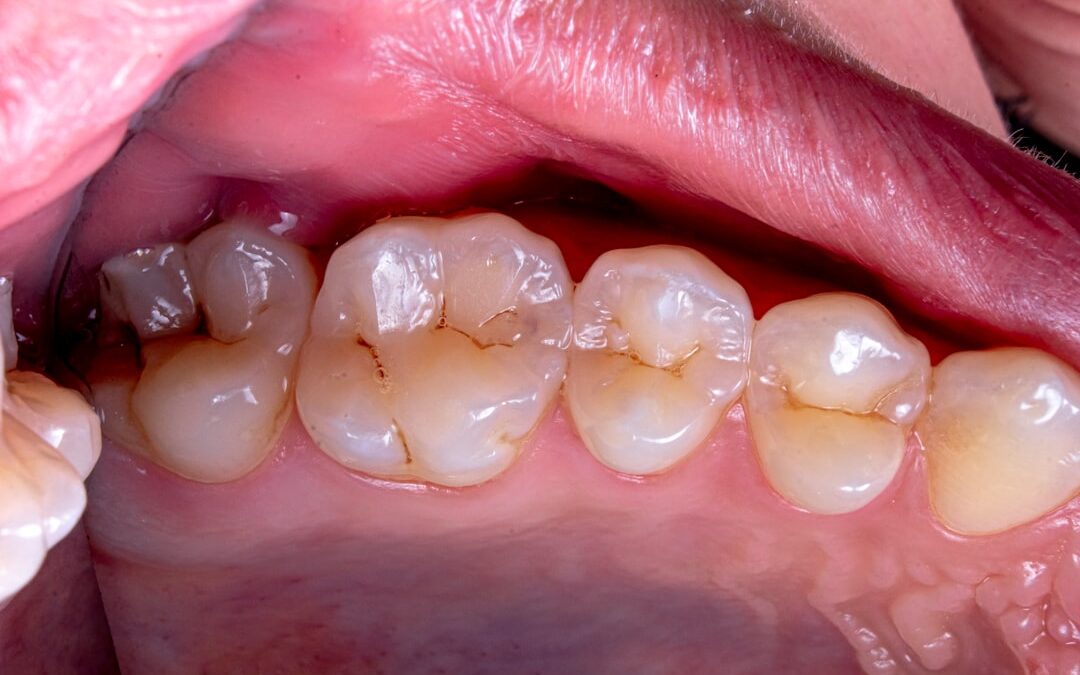 Photo Throat lozenges