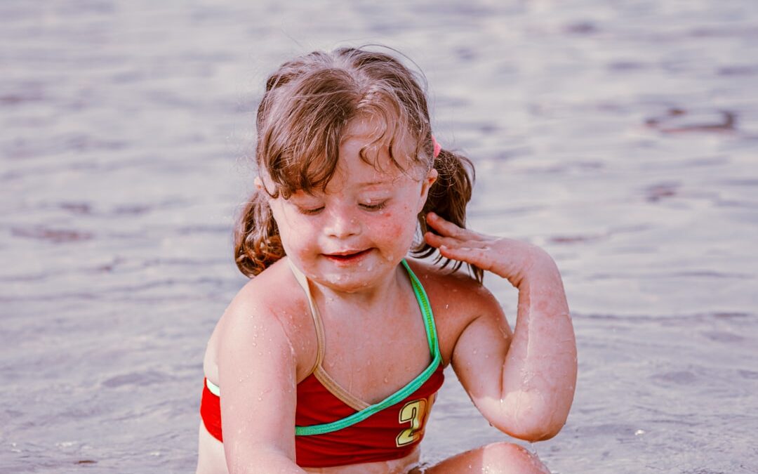 Photo Sunburned child