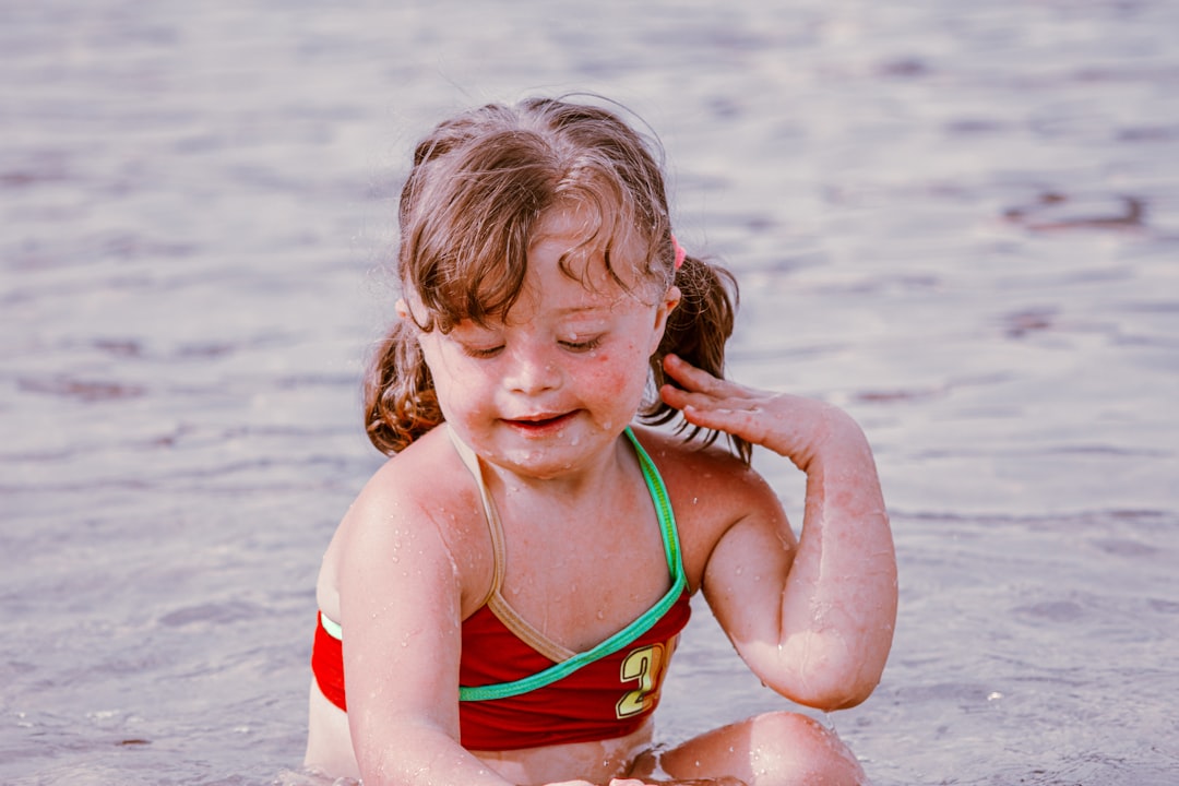 Photo Sunburned child
