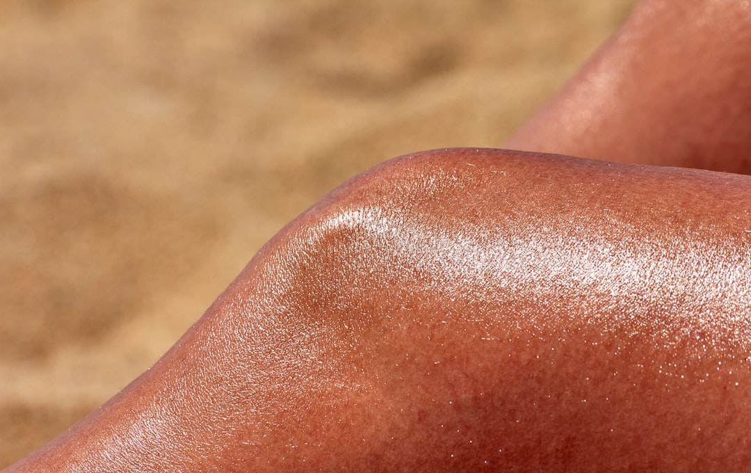 Photo Sunburned skin